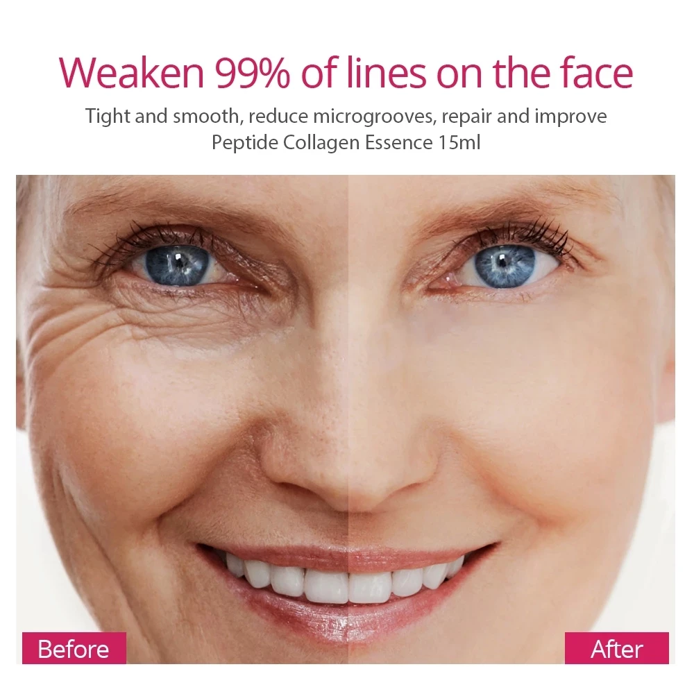 VIBRANT GLAMOUR Collagen Peptides Face Serum Moisturize Whitening Firming Essence Hydrating Anti-Aging Fine Lines Skin Care 2Pcs
VIBRANT GLAMOUR Collagen Peptides Face Serum Moisturize Whitening Firming Essence Hydrating Anti-Aging Fine Lines Skin Care 2Pcs