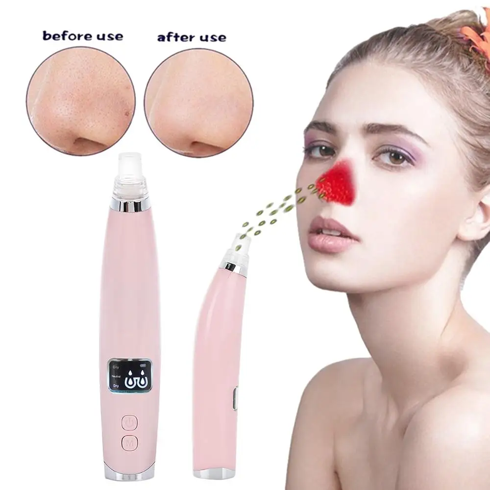 Remove Blackhead Clear Black Head Cleaner Blackhead Remover Plastic 2 Colors Blackhead Vacuum Effective Fast Fashion Acne
Remove Blackhead Clear Black Head Cleaner Blackhead Remover Plastic 2 Colors Blackhead Vacuum Effective Fast Fashion Acne