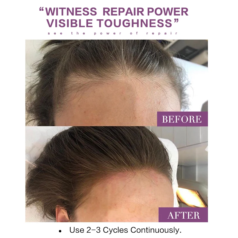 2Pcs Hair Rapid Growth Essence Natural Health Ingredients Woman Hair Care Nutrient Solution Helps Hair Rapid Growth Products
2Pcs Hair Rapid Growth Essence Natural Health Ingredients Woman Hair Care Nutrient Solution Helps Hair Rapid Growth Products