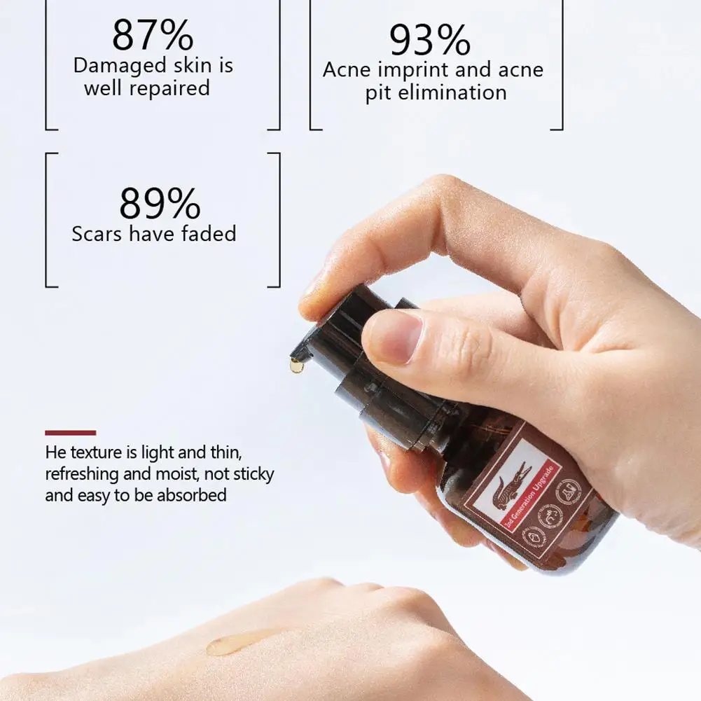 Scar Repair Toner Promote Skin Growth Reduce Scar Area Fade Scar Color Sensitive Skin Moisturizing Repair Oil Control Essence
Scar Repair Toner Promote Skin Growth Reduce Scar Area Fade Scar Color Sensitive Skin Moisturizing Repair Oil Control Essence