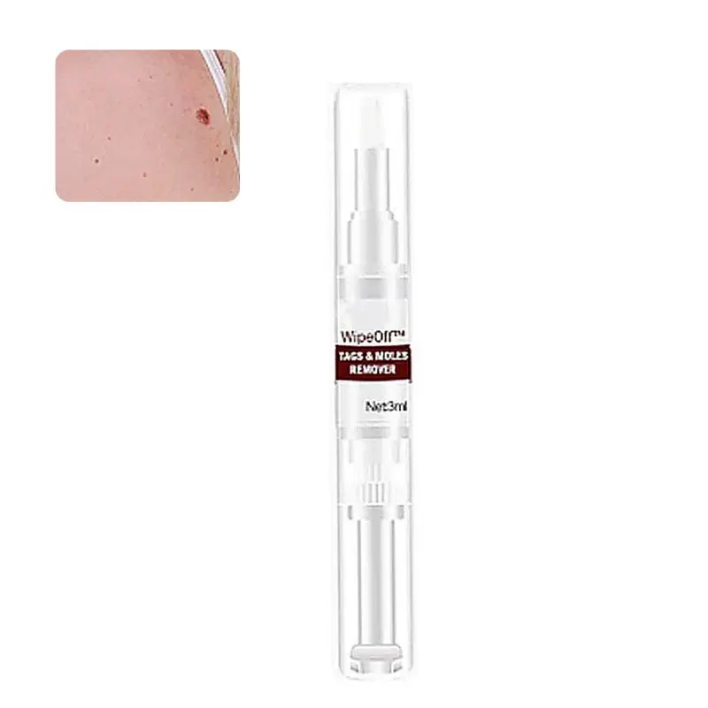 10ml Skin Tags Moles Remover Pen Facial Body Wart Dark Spot Treatment Liquid U2JD
10ml Skin Tags Moles Remover Pen Facial Body Wart Dark Spot Treatment Liquid U2JD