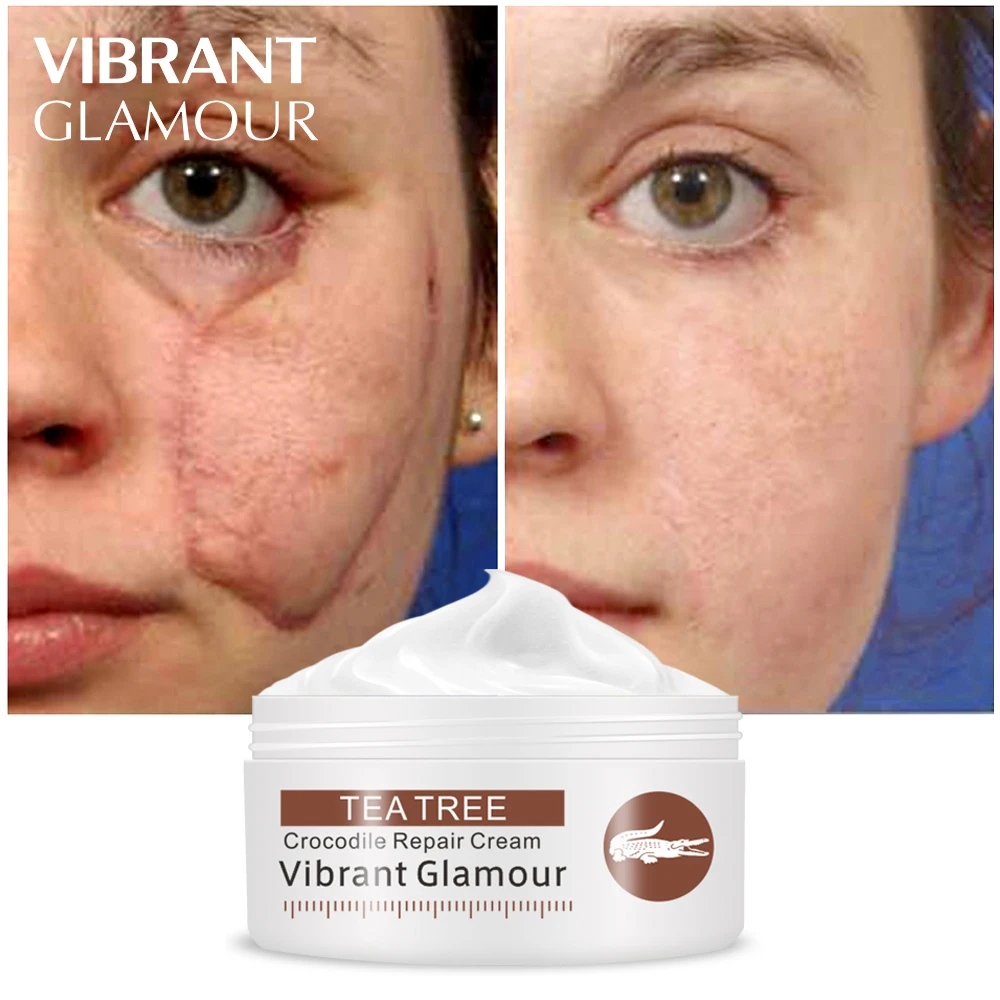 VIBRANT GLAMOUR Repair Scar Cream Crocodile Eye Cream Eliminate Dark Circle Whitening Energetic Remove Stretch Marks Set
VIBRANT GLAMOUR Repair Scar Cream Crocodile Eye Cream Eliminate Dark Circle Whitening Energetic Remove Stretch Marks Set
