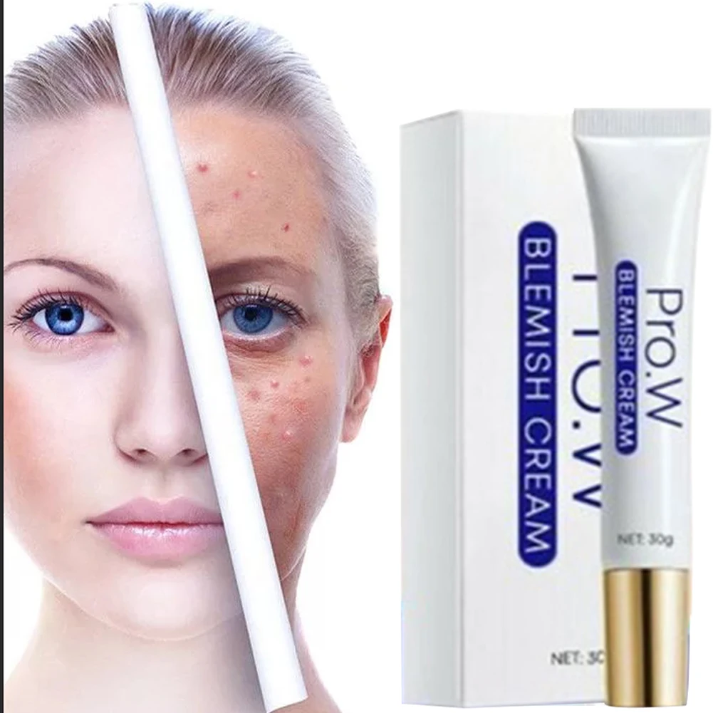 30g Acne Treatment Blemish Cream Freckle Removing Cream Dark Spot Corrector Skin Whitening Fade Cream Face Care Cream
30g Acne Treatment Blemish Cream Freckle Removing Cream Dark Spot Corrector Skin Whitening Fade Cream Face Care Cream