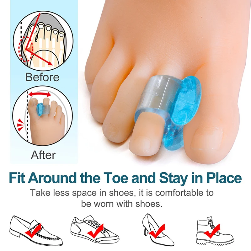 1Pair Soft Silicone Gel Toe Straightener Thumb Crooked Thumb Toe Aligner Positioning Separator Foot Care Tool Hot
1Pair Soft Silicone Gel Toe Straightener Thumb Crooked Thumb Toe Aligner Positioning Separator Foot Care Tool Hot