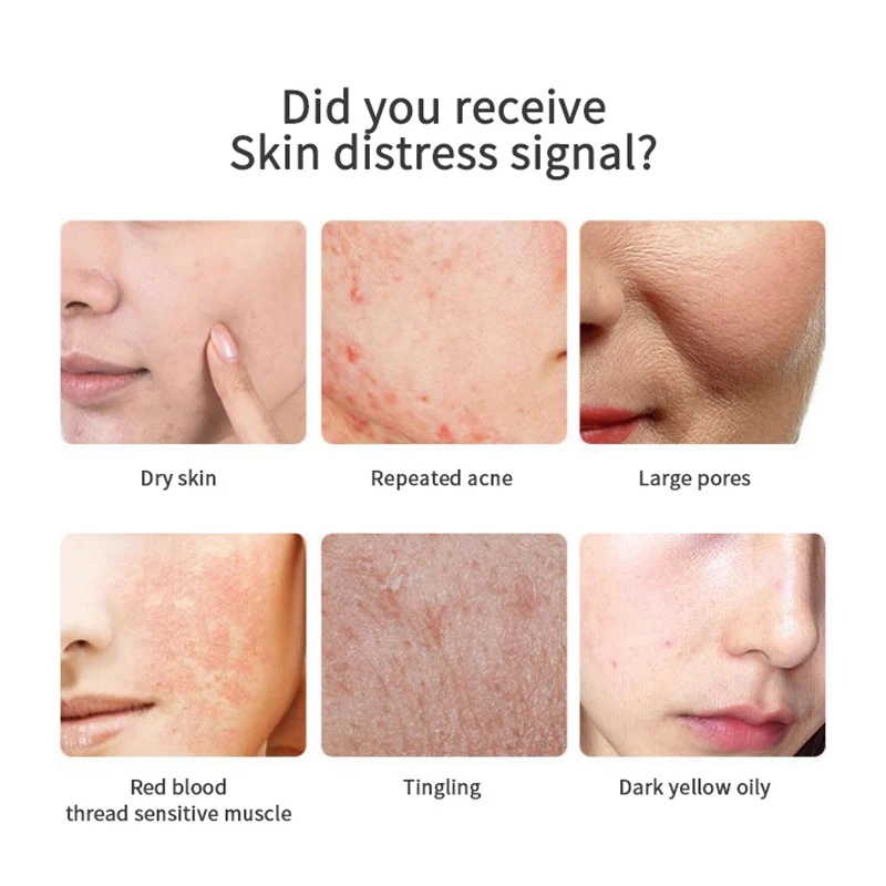20/60/100Pcs Capsules Hyaluronic Acid Extract Face Cream Anti-wrinkle Whitening Cream Face Serum Freckle Skin Care TSLM2
20/60/100Pcs Capsules Hyaluronic Acid Extract Face Cream Anti-wrinkle Whitening Cream Face Serum Freckle Skin Care TSLM2