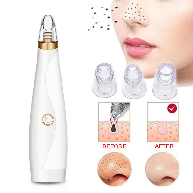 Electronic USB Recharging Blackhead Remover 3 heads Face Pore Vacuum Acne Cleaner Pimple Removal Suction Skin Care Tools
Electronic USB Recharging Blackhead Remover 3 heads Face Pore Vacuum Acne Cleaner Pimple Removal Suction Skin Care Tools