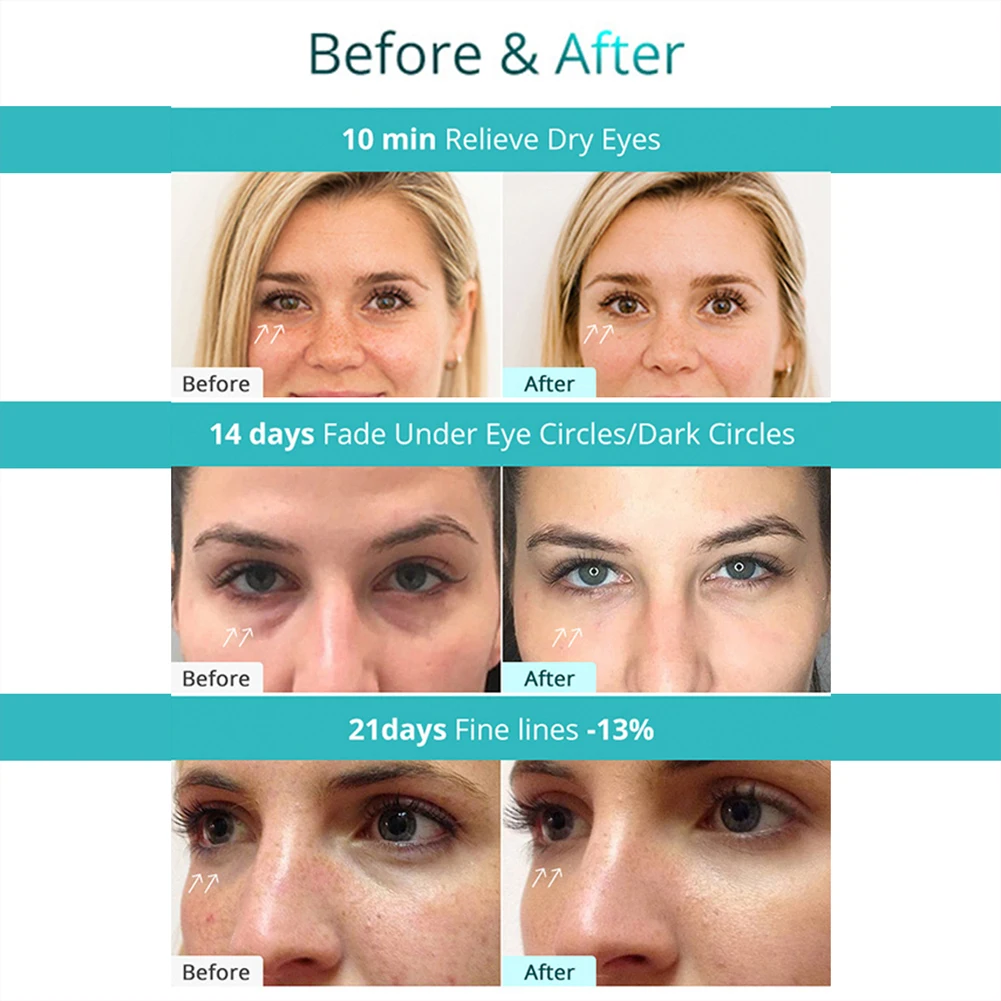 EMS Eye Massage Device Eye Care RF Massage Eye Mask RF Eye Patch Massager Reduce Wrinkles Puffiness Dark Circles Eye Patches
EMS Eye Massage Device Eye Care RF Massage Eye Mask RF Eye Patch Massager Reduce Wrinkles Puffiness Dark Circles Eye Patches