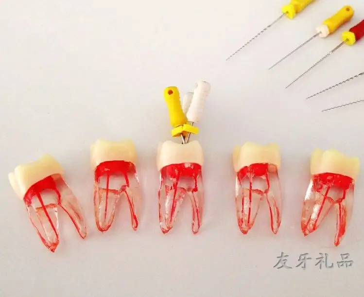 Root tube teeth model practice tooth to grain of root canal model simulation in vitro teeth open pulp one piece
Root tube teeth model practice tooth to grain of root canal model simulation in vitro teeth open pulp one piece
