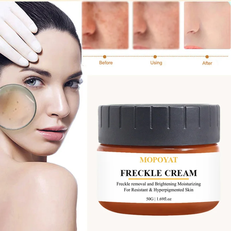 50g Powerful Whitening Freckles Cream powerful spot remover anti Aging Dark Spots Fade Beauty Face Cream Facial Skin Care TSLM1
50g Powerful Whitening Freckles Cream powerful spot remover anti Aging Dark Spots Fade Beauty Face Cream Facial Skin Care TSLM1