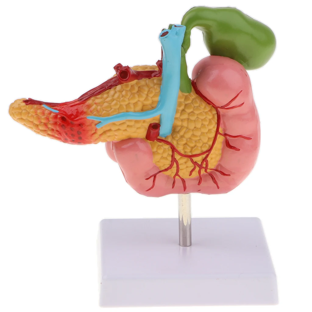 Lifesize человеческая желчная пузырь Duodenum патологическая модель с кровью |