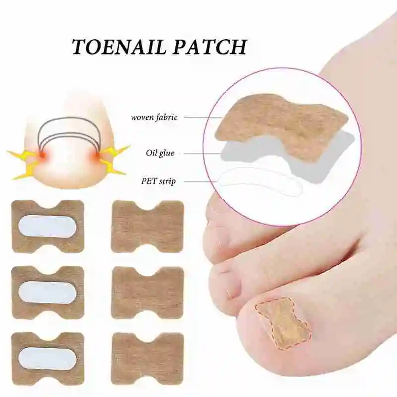 20PCS Nail Correction Stickers Ingrown Toenail Paronychia Care Repair Tools Glue Toe No Recover Foot Nail Needed Treatment
20PCS Nail Correction Stickers Ingrown Toenail Paronychia Care Repair Tools Glue Toe No Recover Foot Nail Needed Treatment