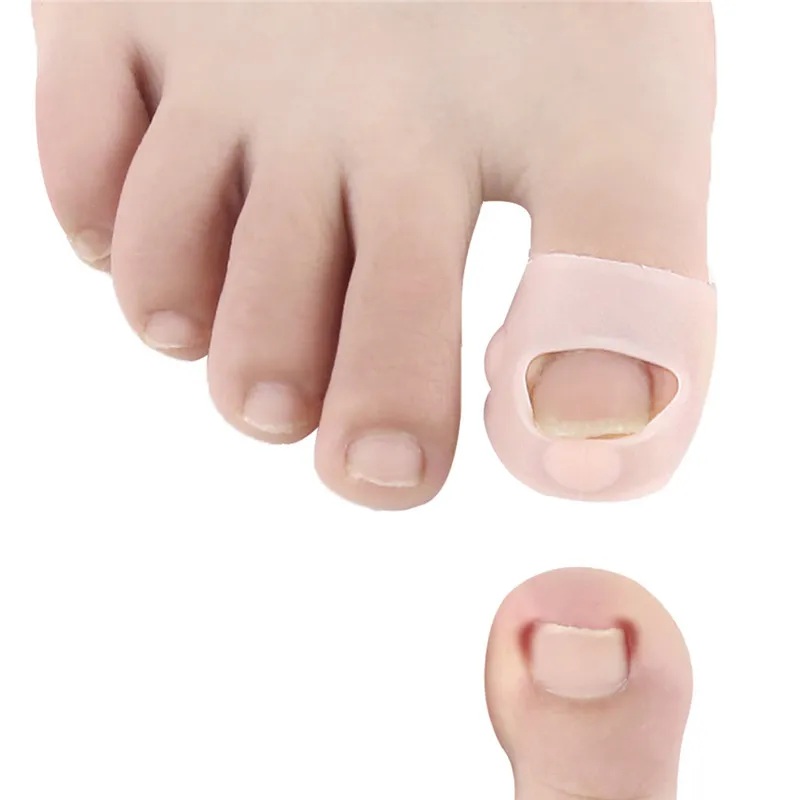 1Pair Ingrown Armor Elastic Patch Straightening Clip Brace Toenail Correction Tool Toe Nail Treatment Pedicure | Красота и здоровье