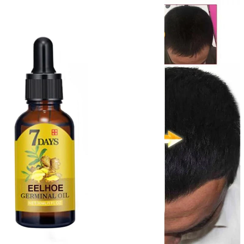 20/40ml Hair Loss Products Natural Ginger Plant Oil No Side Effects Grow Hair Faster Regrowth Hair Growth Products Hair Products
20/40ml Hair Loss Products Natural Ginger Plant Oil No Side Effects Grow Hair Faster Regrowth Hair Growth Products Hair Products