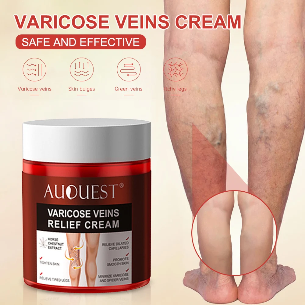 Varicose Veins Cream Swollen Legs Pain Relief Spider Veins Treatment Effective Legs Pain Relief Ointment Body Care Fast Delivery
Varicose Veins Cream Swollen Legs Pain Relief Spider Veins Treatment Effective Legs Pain Relief Ointment Body Care Fast Delivery