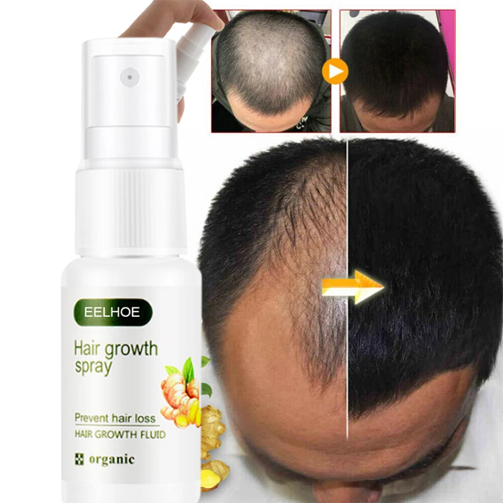 Hair Growth Spray Natural Hair Treatment for Longer Thicker Fuller Hair Prevent Hair Loss Hair Regrowth Spray
Hair Growth Spray Natural Hair Treatment for Longer Thicker Fuller Hair Prevent Hair Loss Hair Regrowth Spray