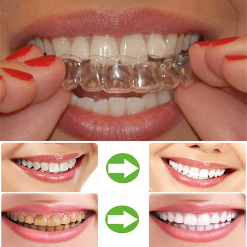 4pcs Silicone Teeth Whitening Bleaching Braces Teeth Clenching Grinding Dental Bite Sleep Aid Orthodontic Oral Care Tooth Tools
4pcs Silicone Teeth Whitening Bleaching Braces Teeth Clenching Grinding Dental Bite Sleep Aid Orthodontic Oral Care Tooth Tools