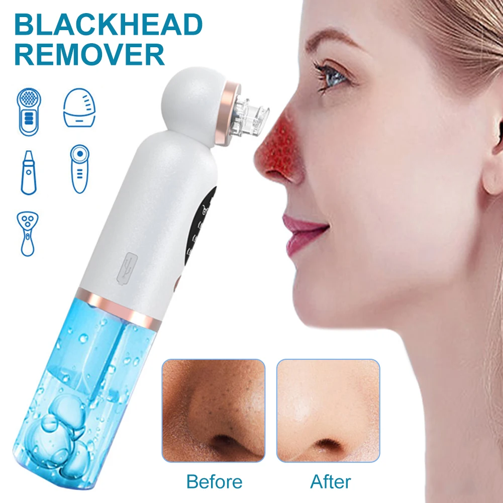 Blackhead Remover Small Bubble Cleanser Facial Deep Pore Cleaning Kit Rechargeable Vacuum Cleanser Easy Operation Fast Delivery
Blackhead Remover Small Bubble Cleanser Facial Deep Pore Cleaning Kit Rechargeable Vacuum Cleanser Easy Operation Fast Delivery