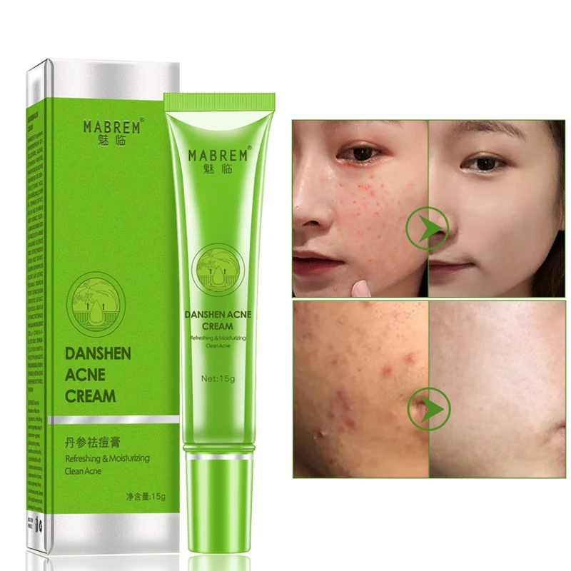 1pcs Repairing Acne Face Cream Fade Spots Oil Control Shrink Pores Acne Treatment Whitening Moisturizing Skin Care Day Cream
1pcs Repairing Acne Face Cream Fade Spots Oil Control Shrink Pores Acne Treatment Whitening Moisturizing Skin Care Day Cream