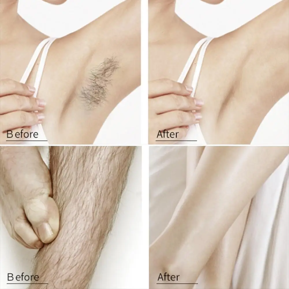150ml Hair Removal Spray Natural Painless Hair Removal Spray Cream Stop Hair Growth Body Bikini Legs Hair Remover Foam Mousse
150ml Hair Removal Spray Natural Painless Hair Removal Spray Cream Stop Hair Growth Body Bikini Legs Hair Remover Foam Mousse