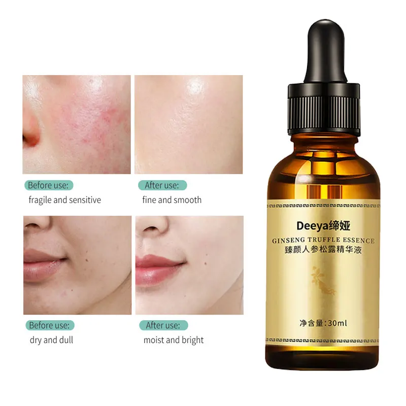 Ginseng Repair Serum White Truffle Anti-Aging Face Serum Firming Moisturizing Repair Skin Care Essence 30Ml Anti Wrinkle Japan
Ginseng Repair Serum White Truffle Anti-Aging Face Serum Firming Moisturizing Repair Skin Care Essence 30Ml Anti Wrinkle Japan