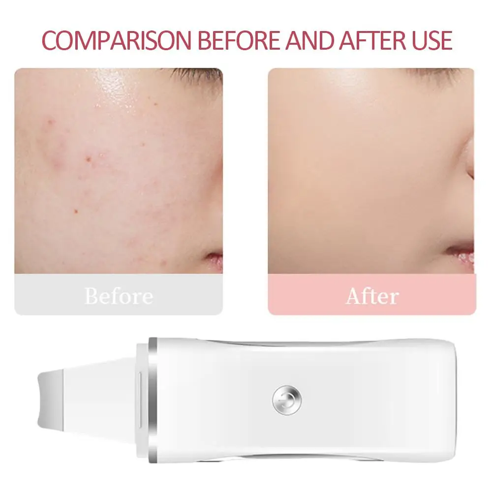 Clear Beauty Health Blackhead Skin Scrubber Face Beauty Apparatus Ultrasonic USB Charging Black Head Cleaner
Clear Beauty Health Blackhead Skin Scrubber Face Beauty Apparatus Ultrasonic USB Charging Black Head Cleaner