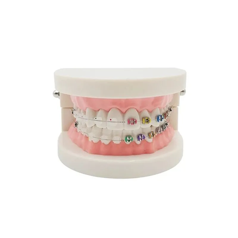 Dental Ortho Teach Treatment Study Teeth Model Half Metal Half Ceramic Brackets Buccal Tubes Wires
Dental Ortho Teach Treatment Study Teeth Model Half Metal Half Ceramic Brackets Buccal Tubes Wires