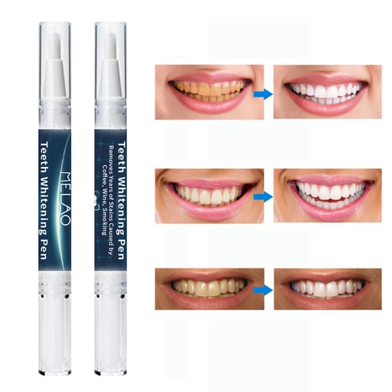 Teeth Whitening Pen Remove Yellow Teeth Cigarette Dental Plaque Brighten Teeth Cleaning Oral Hygiene
Teeth Whitening Pen Remove Yellow Teeth Cigarette Dental Plaque Brighten Teeth Cleaning Oral Hygiene