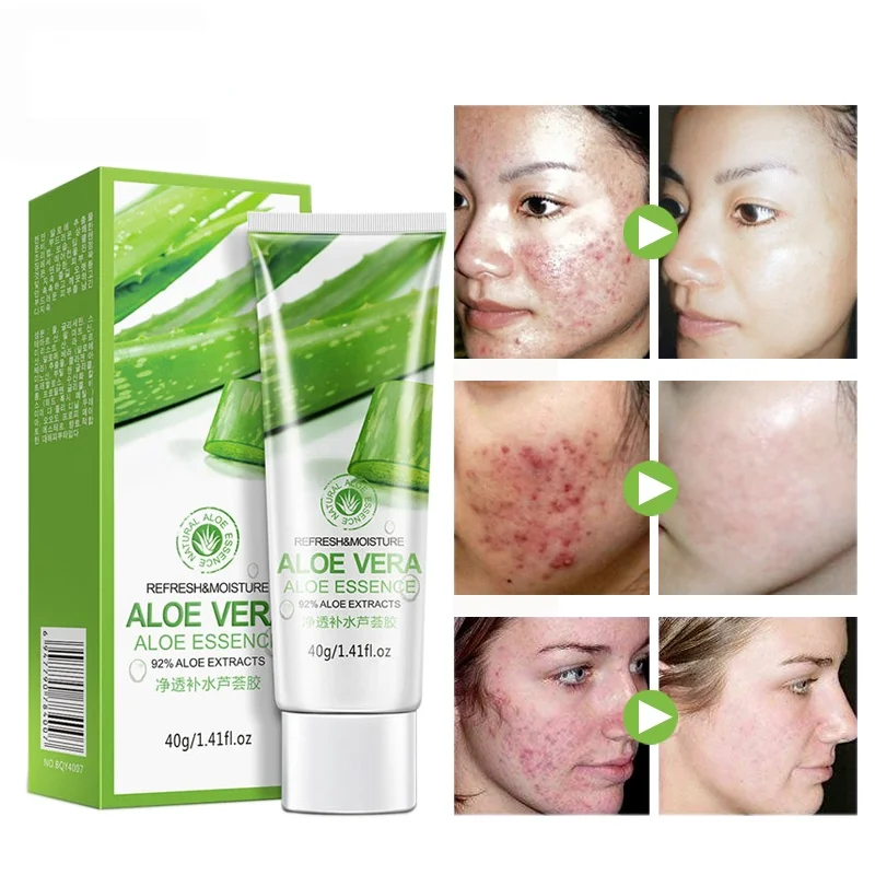 Aloe Vera Gel Face Cream Hyaluronic Acid Anti Winkle Whitening Moisturizing Acne Treatment Cream Skin Care
Aloe Vera Gel Face Cream Hyaluronic Acid Anti Winkle Whitening Moisturizing Acne Treatment Cream Skin Care