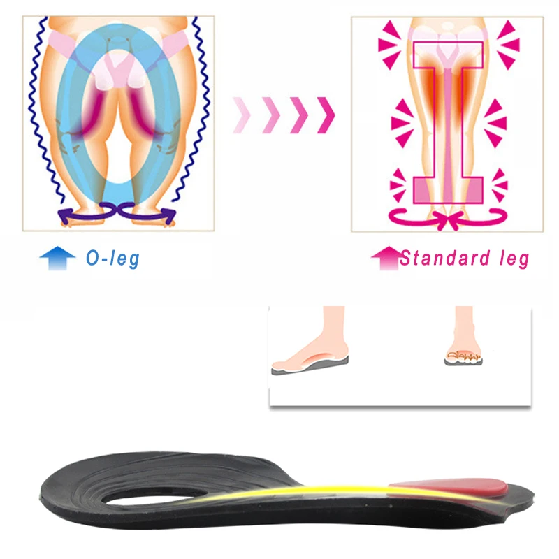Unisex O/X Legs Correction Insoles Orthopedic Insoles Arch Support Orthoses Pad Massaging Shoe Insoles Foot Health PUZ77
Unisex O/X Legs Correction Insoles Orthopedic Insoles Arch Support Orthoses Pad Massaging Shoe Insoles Foot Health PUZ77