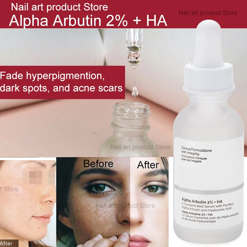 Ordinary Azelaic Acid Essence Azelaic Acid 10% light gel texture, brighten the skin, even out the complexion, refine the texture
Ordinary Azelaic Acid Essence Azelaic Acid 10% light gel texture, brighten the skin, even out the complexion, refine the texture