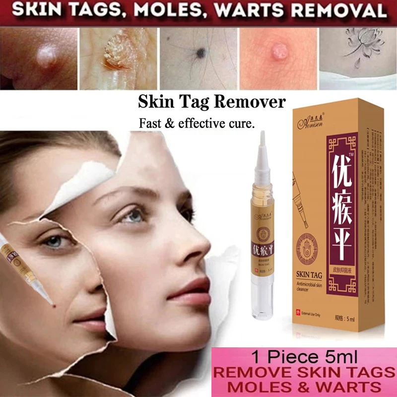 Skin Tag Remover Medical Papillomas Removal of Warts Liquid From Skin Tags Removing Against Moles Remover Anti Verruca Remedy
Skin Tag Remover Medical Papillomas Removal of Warts Liquid From Skin Tags Removing Against Moles Remover Anti Verruca Remedy