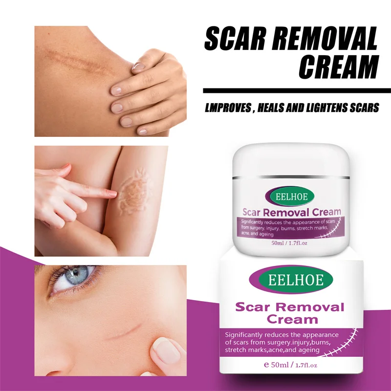 Belly Wrinkle Cream for Pregnant Women Belly Firming Cream to Reduce Postpartum Stretch Mark Repair Cream
Belly Wrinkle Cream for Pregnant Women Belly Firming Cream to Reduce Postpartum Stretch Mark Repair Cream