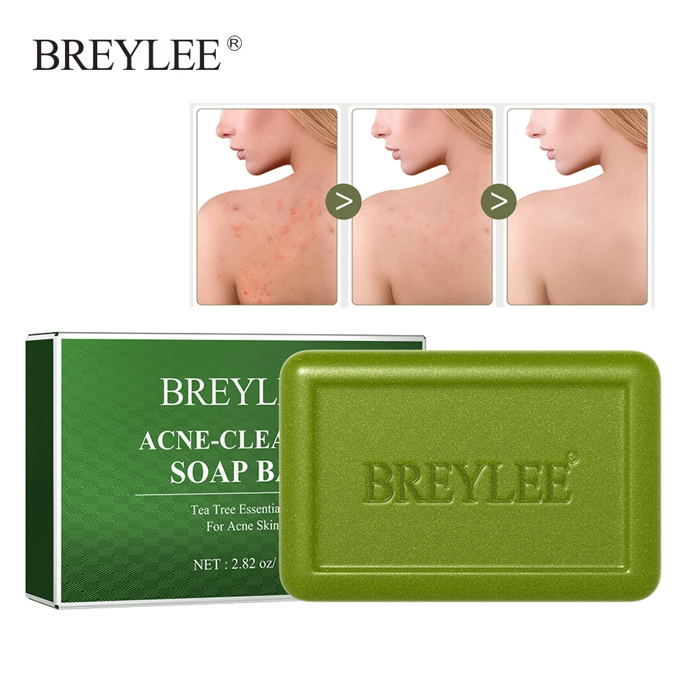Мыло для очистки акне BREYLEE, натуральное эфирное масло чайного дерева, мыло ручной работы для уменьшения акне, увлажнения, ухода за кожей
Мыло для очистки акне BREYLEE, натуральное эфирное масло чайного дерева, мыло ручной работы для уменьшения акне, увлажнения, ухода за кожей
