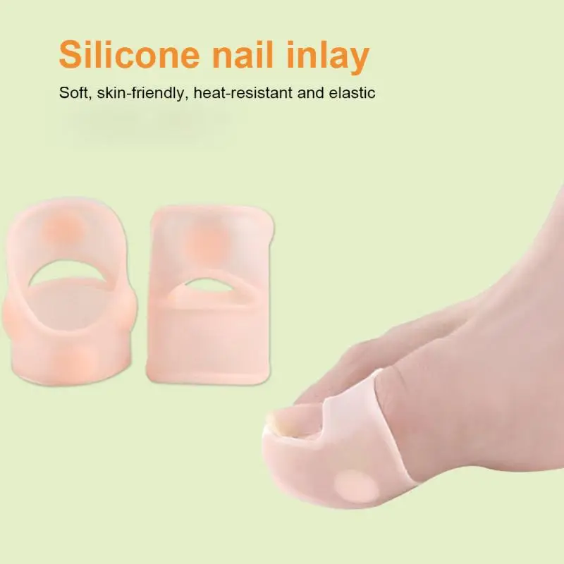 Nail Inlay Appliance Nail Groove Prevent Nail Growing Ingrown Nail Appliance Orthosis Painless Correction Relief Foot Care Tool
Nail Inlay Appliance Nail Groove Prevent Nail Growing Ingrown Nail Appliance Orthosis Painless Correction Relief Foot Care Tool