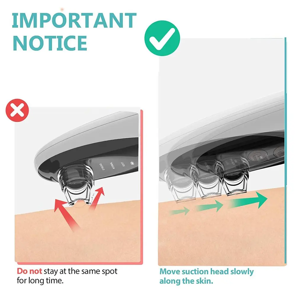 Visible Blackheads Vacuum Facial Pores Electric Suction Instrument Blackhead Removal Suction Intelligent Cleaner
Visible Blackheads Vacuum Facial Pores Electric Suction Instrument Blackhead Removal Suction Intelligent Cleaner