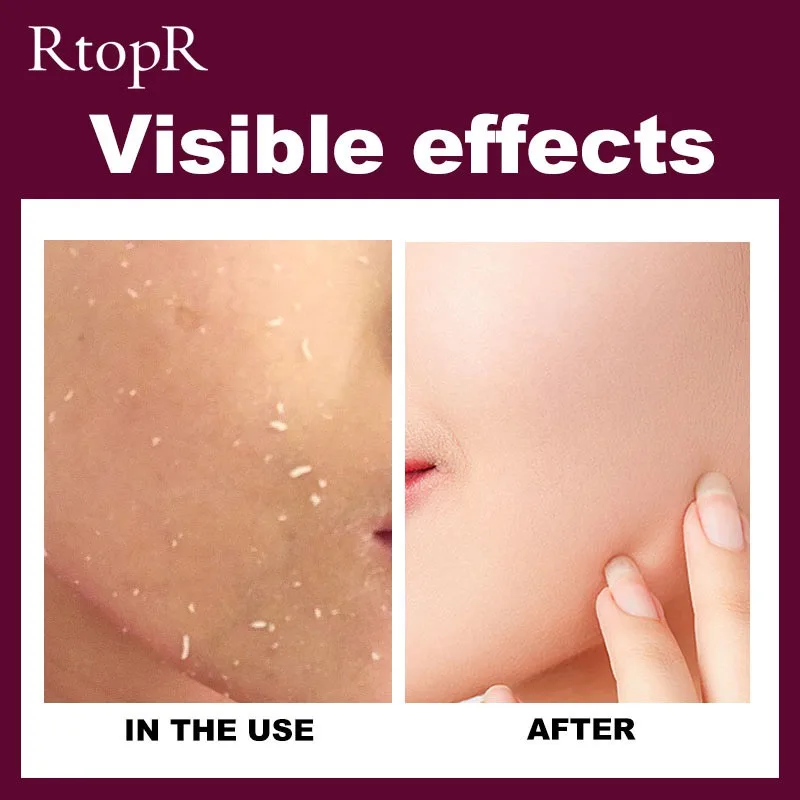 40g Deep Cleansing Exfoliating Peeling Gel Facial Cleanser Deep Exfoliator Gel Scrub Smooth Moisturizing Skin Care Cleaner 
40g Deep Cleansing Exfoliating Peeling Gel Facial Cleanser Deep Exfoliator Gel Scrub Smooth Moisturizing Skin Care Cleaner