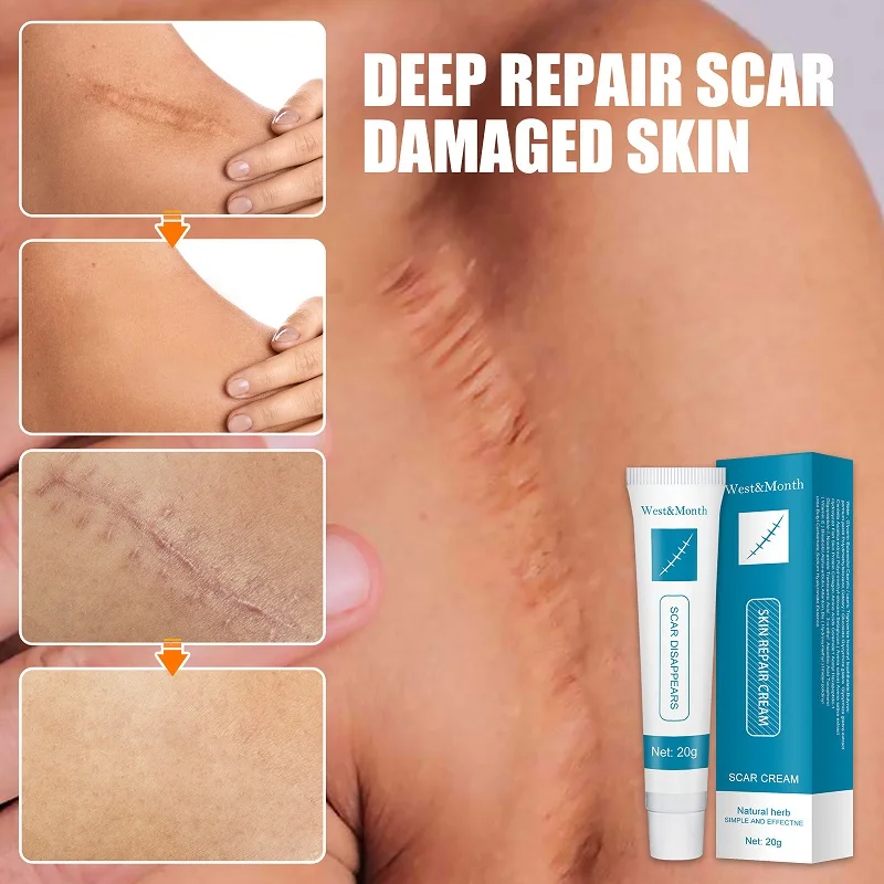 Acne Scar Removal Cream Repair Burn Surgical Scars Stretch Marks Cell Regeneration Enhance Natural Herb Skin Care Plaster 20g
Acne Scar Removal Cream Repair Burn Surgical Scars Stretch Marks Cell Regeneration Enhance Natural Herb Skin Care Plaster 20g