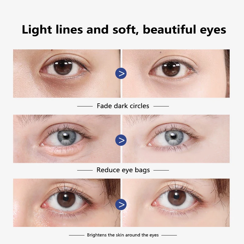 Vitamin A Eye Creams Massage Rolling Fades Dark Circles Eye Cream Beauty Eyes Massager Nourish And Firm Eye Care TSLM1
Vitamin A Eye Creams Massage Rolling Fades Dark Circles Eye Cream Beauty Eyes Massager Nourish And Firm Eye Care TSLM1