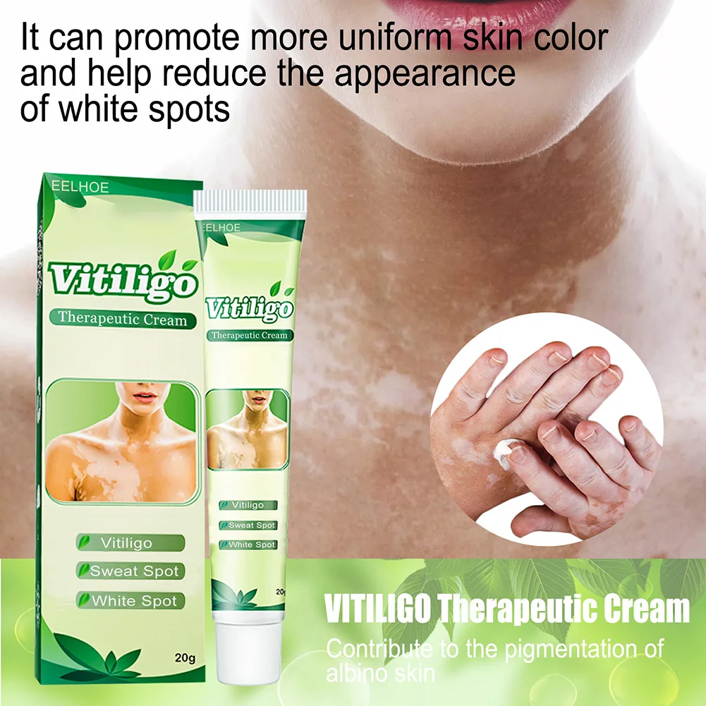 20g New Medical Vitiligo Ointment Natural Herbal Mycosis Leukoplakia Repair Ointment Skin Care White Spot Cream
20g New Medical Vitiligo Ointment Natural Herbal Mycosis Leukoplakia Repair Ointment Skin Care White Spot Cream