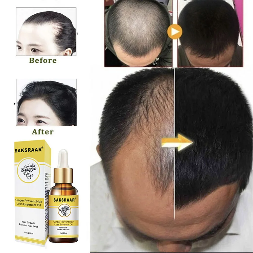 Effective Ginger Hair Growth Essential Oils Hair Care Hair Growth Serum Essence Hair Loss Liquid Health Care Beauty Dense Hair
Effective Ginger Hair Growth Essential Oils Hair Care Hair Growth Serum Essence Hair Loss Liquid Health Care Beauty Dense Hair