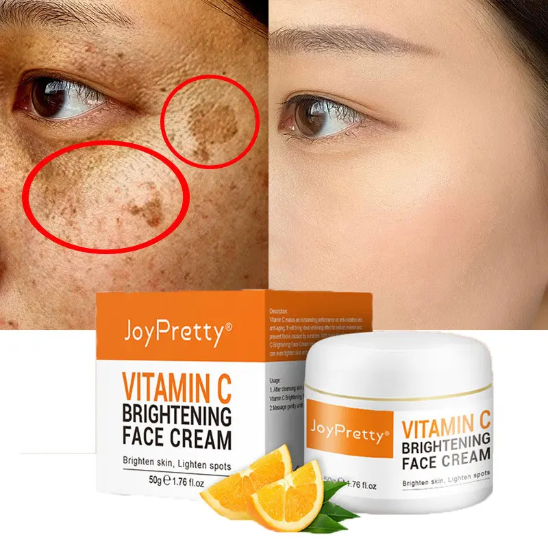 Vitamin C Whitening Freckle Face Cream Remove Dark Spots Brighten Skin Care Facial Serum Moisturizing Whiten Korea Cosmetic 50ml
Vitamin C Whitening Freckle Face Cream Remove Dark Spots Brighten Skin Care Facial Serum Moisturizing Whiten Korea Cosmetic 50ml
