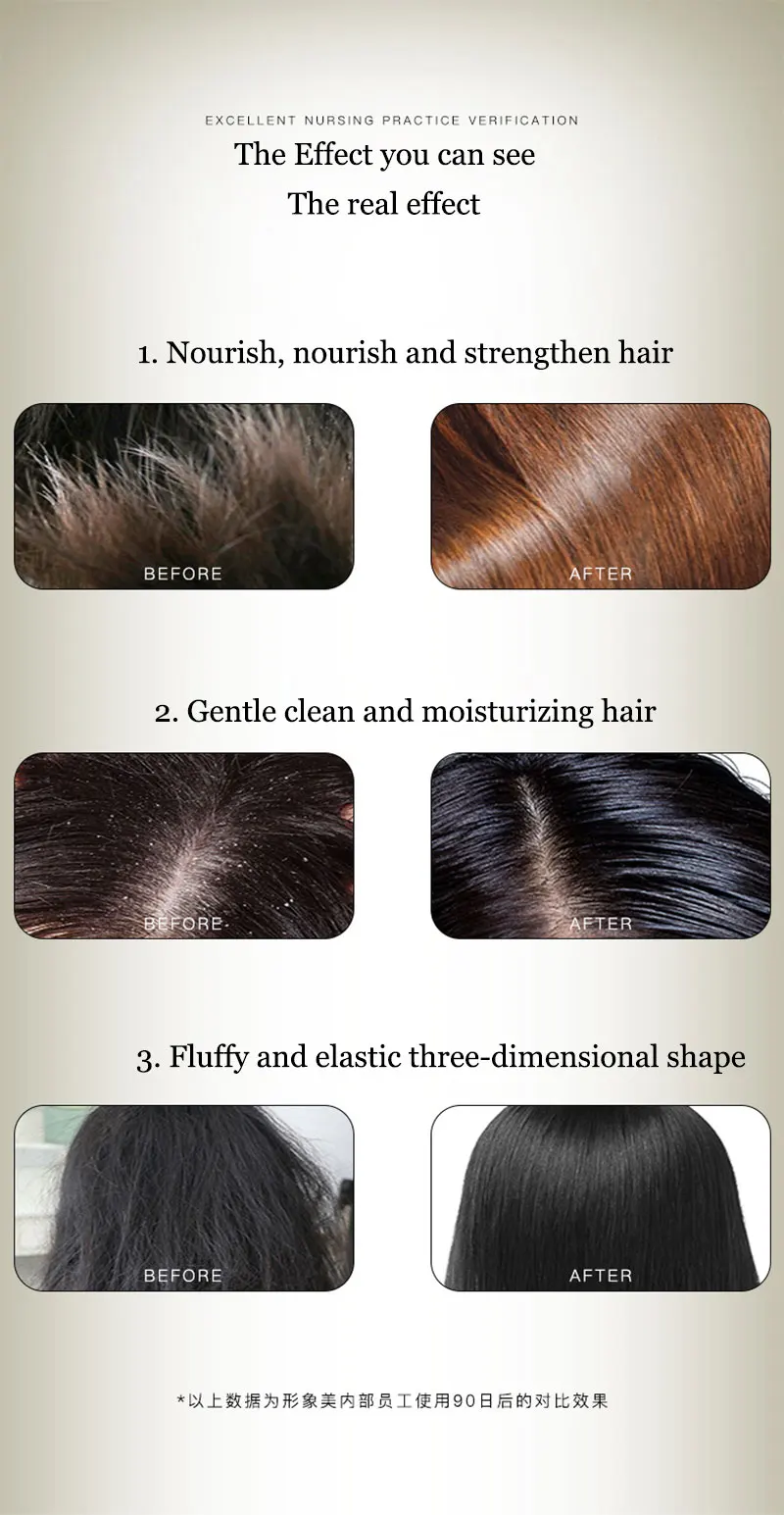 Chinese Formula Ginger Shampoo for Anti Hair Loss Fast Growth Hair Grow Thicker Dense Control Hair Oil Treatment Dandruff 300ml
Chinese Formula Ginger Shampoo for Anti Hair Loss Fast Growth Hair Grow Thicker Dense Control Hair Oil Treatment Dandruff 300ml