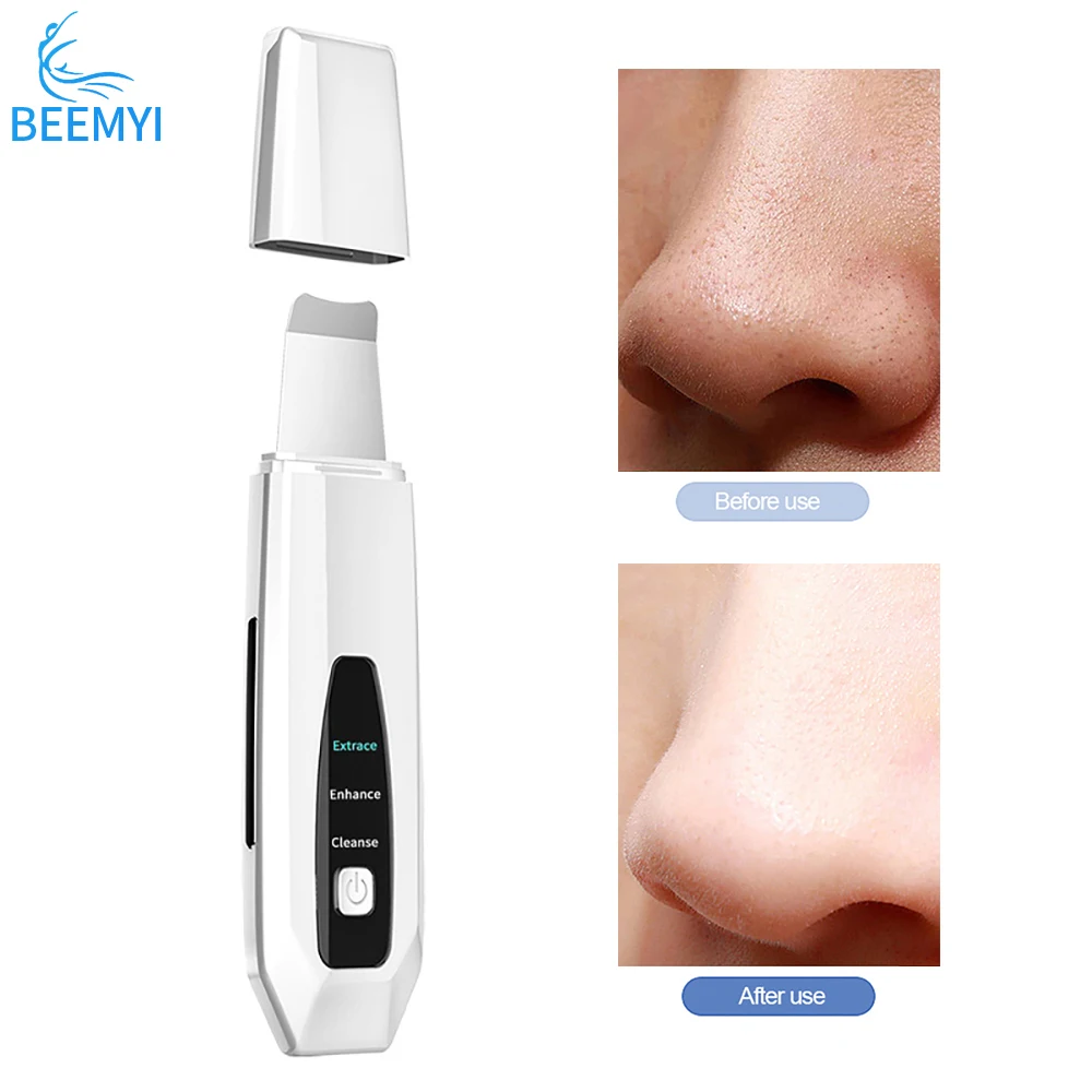 Beemyi EMS Ultrasonic Skin Scrubber Face Spatula Blackhead Wrinkle Remover Facial Lifting beauty Shovel Clean Cavitation Peeling
Beemyi EMS Ultrasonic Skin Scrubber Face Spatula Blackhead Wrinkle Remover Facial Lifting beauty Shovel Clean Cavitation Peeling