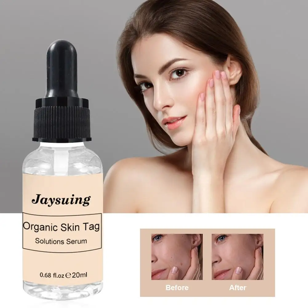 Mole And Skin Tag Remover Lotion Traceless Skin Repair Lotion Organic Tags Solutions Serum For Remove Moles And Skin Tags
Mole And Skin Tag Remover Lotion Traceless Skin Repair Lotion Organic Tags Solutions Serum For Remove Moles And Skin Tags