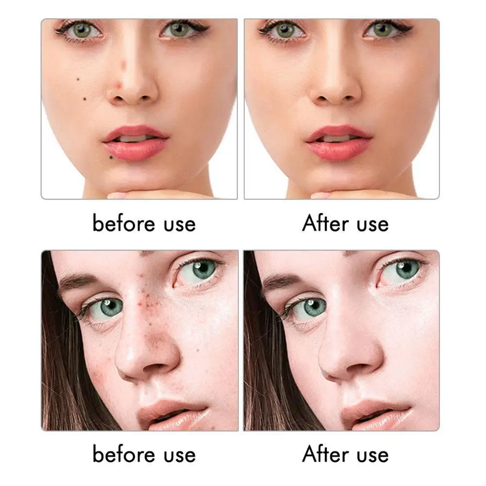 Spot Scanning Mole Removal Pen Beauty Salon Equipment Beauty Liquid Crystal Removal White Pen Spot Mole Machine Spot S0M9
Spot Scanning Mole Removal Pen Beauty Salon Equipment Beauty Liquid Crystal Removal White Pen Spot Mole Machine Spot S0M9
