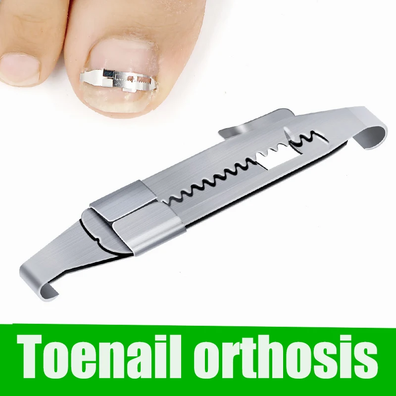 Ingrown Toenails Correction Pedicure Foot toe Nail Care Tools Straightening Clip Brace corrector Nail Correction Tool
Ingrown Toenails Correction Pedicure Foot toe Nail Care Tools Straightening Clip Brace corrector Nail Correction Tool