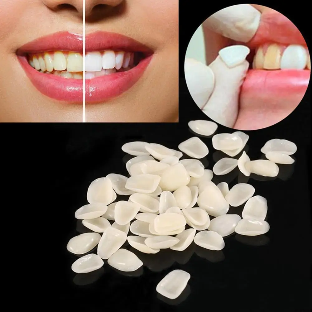1Pack Dental Ultra-Thin Whitening Veneers Resin Porcelain Anterior Film Upper Dental Temporary Teeth Materials Whitening I0T7 
1Pack Dental Ultra-Thin Whitening Veneers Resin Porcelain Anterior Film Upper Dental Temporary Teeth Materials Whitening I0T7