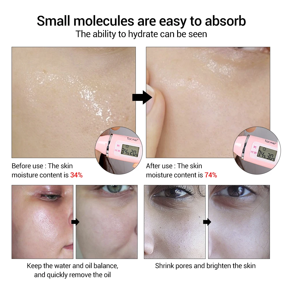 LANBENA Hyaluronic Acid Serum 4PCS Skin Care Essence Serum Moisturizing Acne Treatment Repair Whitening Anti Aning Winkles
LANBENA Hyaluronic Acid Serum 4PCS Skin Care Essence Serum Moisturizing Acne Treatment Repair Whitening Anti Aning Winkles
