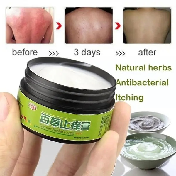 25g Natural Herbal Ointment Psoriasi Cream Effective for Dermatitis Psoriasis Eczema Cream
25g Natural Herbal Ointment Psoriasi Cream Effective for Dermatitis Psoriasis Eczema Cream