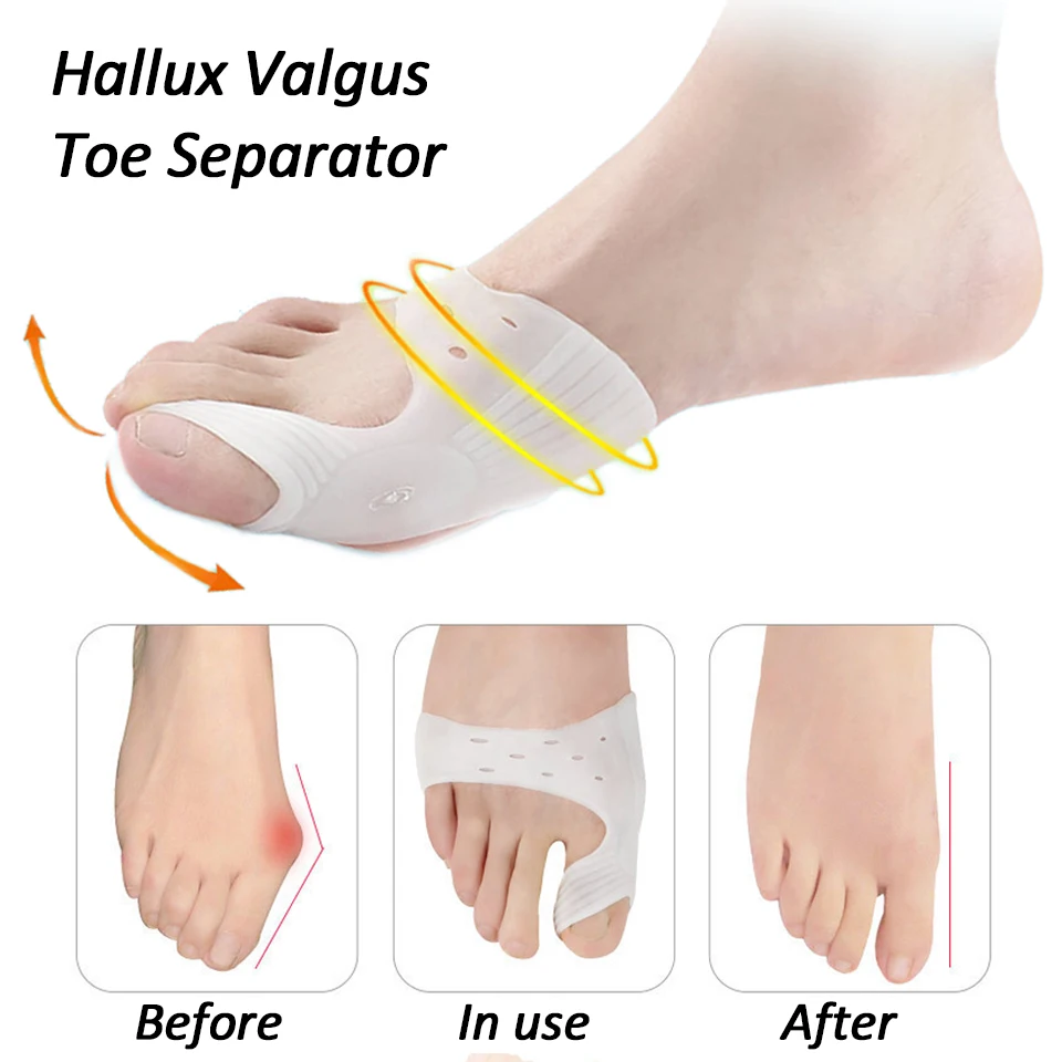 2Pcs Silicone Hallux Valgus Toe Separator Silicone Insoles Toe Overlapping Pain Relieve Spreader Foot Protector Inserts Orthosis
2Pcs Silicone Hallux Valgus Toe Separator Silicone Insoles Toe Overlapping Pain Relieve Spreader Foot Protector Inserts Orthosis